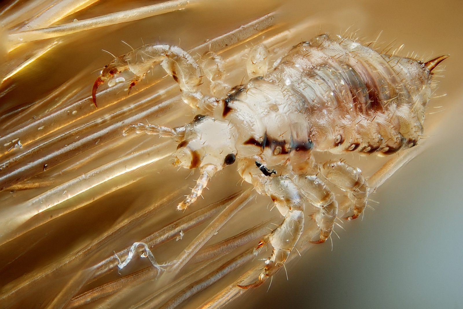 Kopflausbefall (Pediculosis capitis) bei Kindern