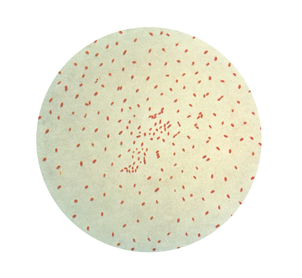 Pertussis - Keuchhusten