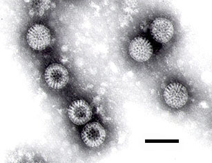 Rotavirus-Brechdurchfall