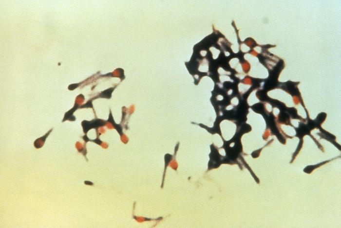 Tetanus, Wundstarrkrampf